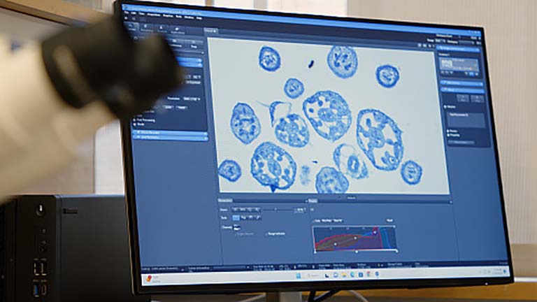 Computer screen displaying an image of cross sections of Arabidopsis flowers in different stages of development.