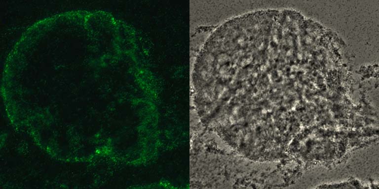 Vibrio cholerae biofilm on a chitin bead stained with a fluorescent DNA intercalating dye to visualize bacterial cells. LEFT: epifluorescence. RIGHT: phase contrast. 